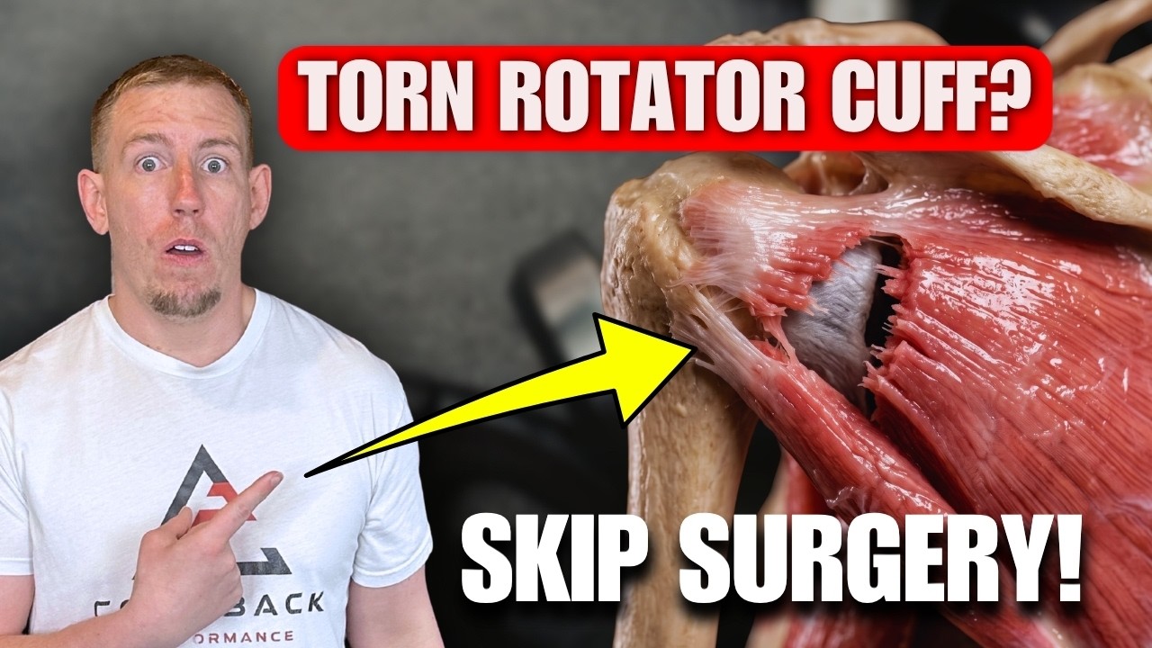 exercises for torn rotator cuff without surgery