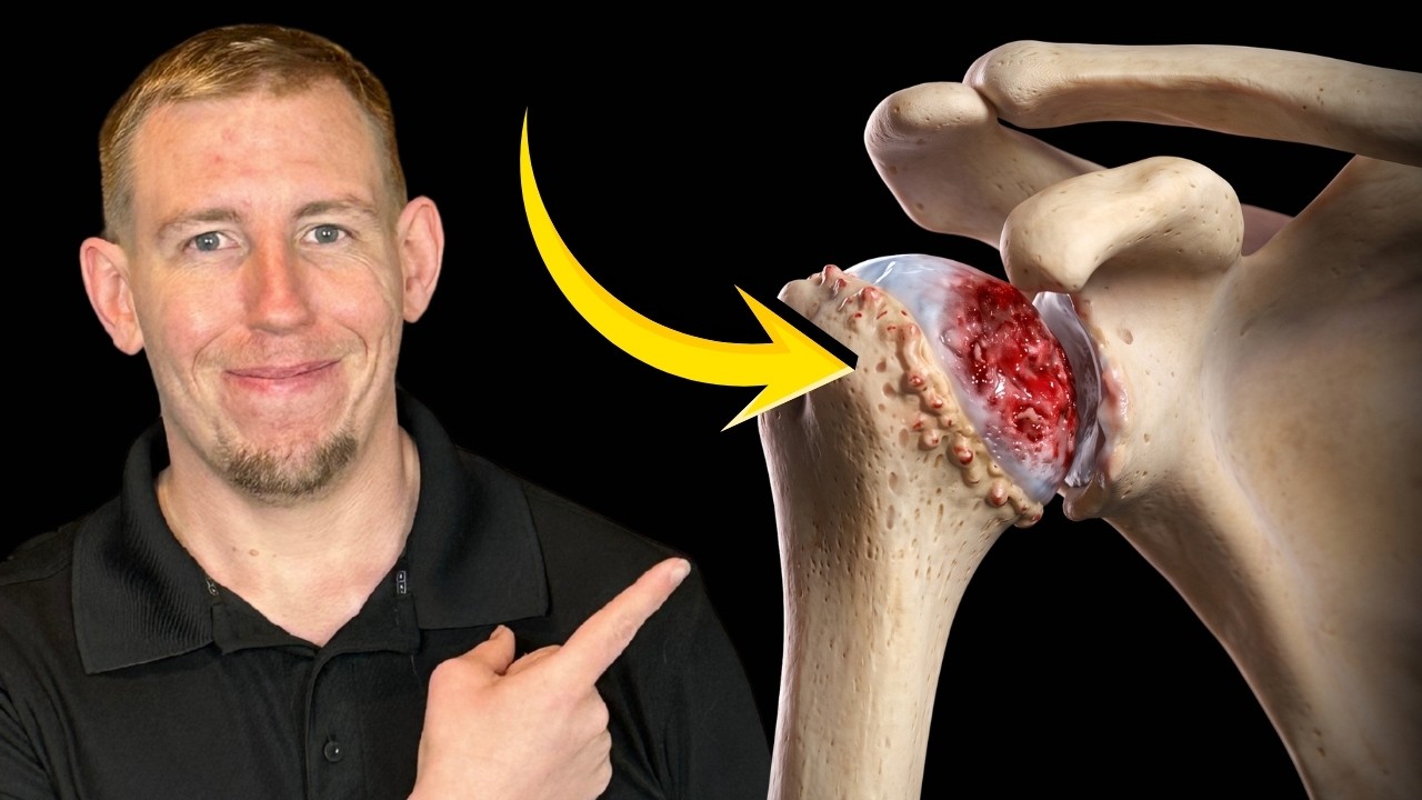 shoulder arthritis relief exercises